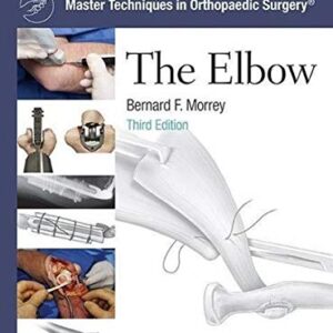 Master Techniques in Orthopaedic Surgery: The Elbow