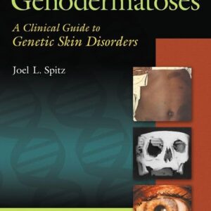 Genodermatoses: A Clinical Guide to Genetic Skin Disorders