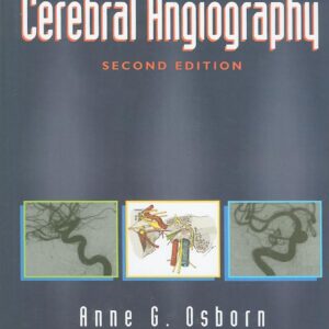 Diagnostic Cerebral Angiography
