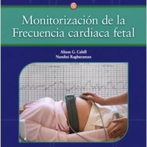 Monitorización de la frecuencia cardiaca fetal