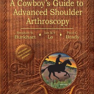 Burkhart's View of the Shoulder: A Cowboy's Guide to Advanced Shoulder Arthroscopy
