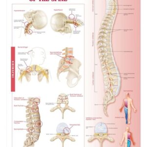 Anatomy and Injuries of The Spine: Anatomical Chart