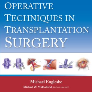 Operative Techniques in Transplantation Surgery