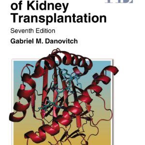 Handbook of Kidney Transplantation