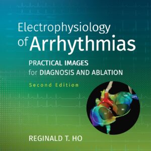 Electrophysiology of Arrhythmias: Practical Images for Diagnosis and Ablation