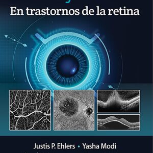 OCT y OCTA en trastornos de la retina (Spanish Edition)