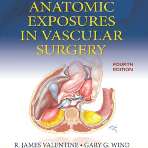 Anatomic Exposures in Vascular Surgery