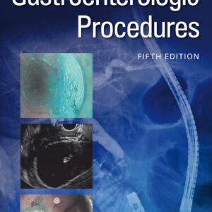 Handbook of Gastroenterologic Procedures (Lippincott Williams & Wilkins Handbook Series)