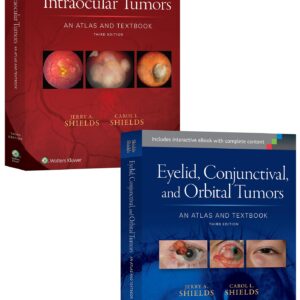 Shields: Intraocular Tumors 3e and Eyelid