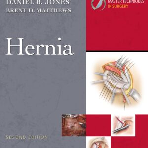 Master Techniques in Surgery: Hernia: Print + eBook with Multimedia