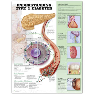 Understanding Type 2 Diabetes Anatomical Chart