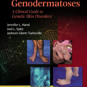 Spitz's Genodermatoses: A Full Color Clinical Guide to Genetic Skin Disorders