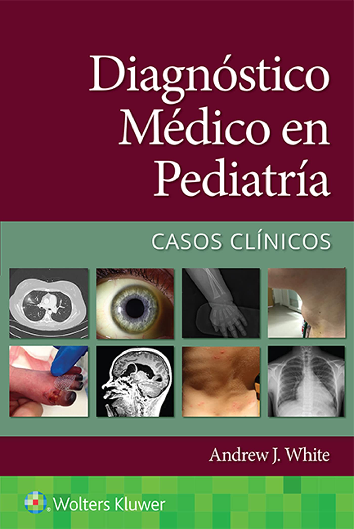 Diagnóstico médico en pediatría. Casos clínicos (Spanish Edition)