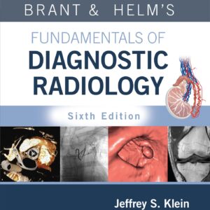 Brant & Helms' Fundamentals of Diagnostic Radiology: Print + eBook with Multimedia