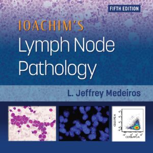 Ioachim's Lymph Node Pathology