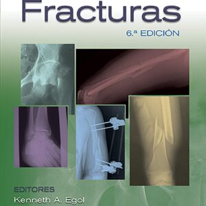 Manual de fracturas (Spanish Edition)