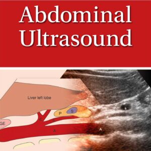 Pocket Anatomy & Protocols for Abdominal Ultrasound