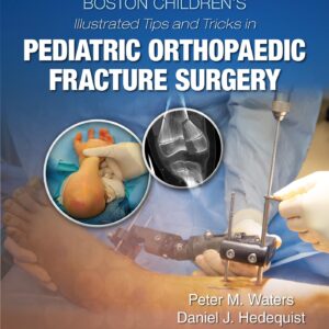 Boston Children’s Illustrated Tips and Tricks in Pediatric Orthopaedic Fracture Surgery