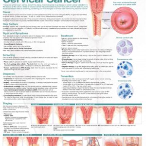 Understanding Cervical Cancer Anatomical Chart