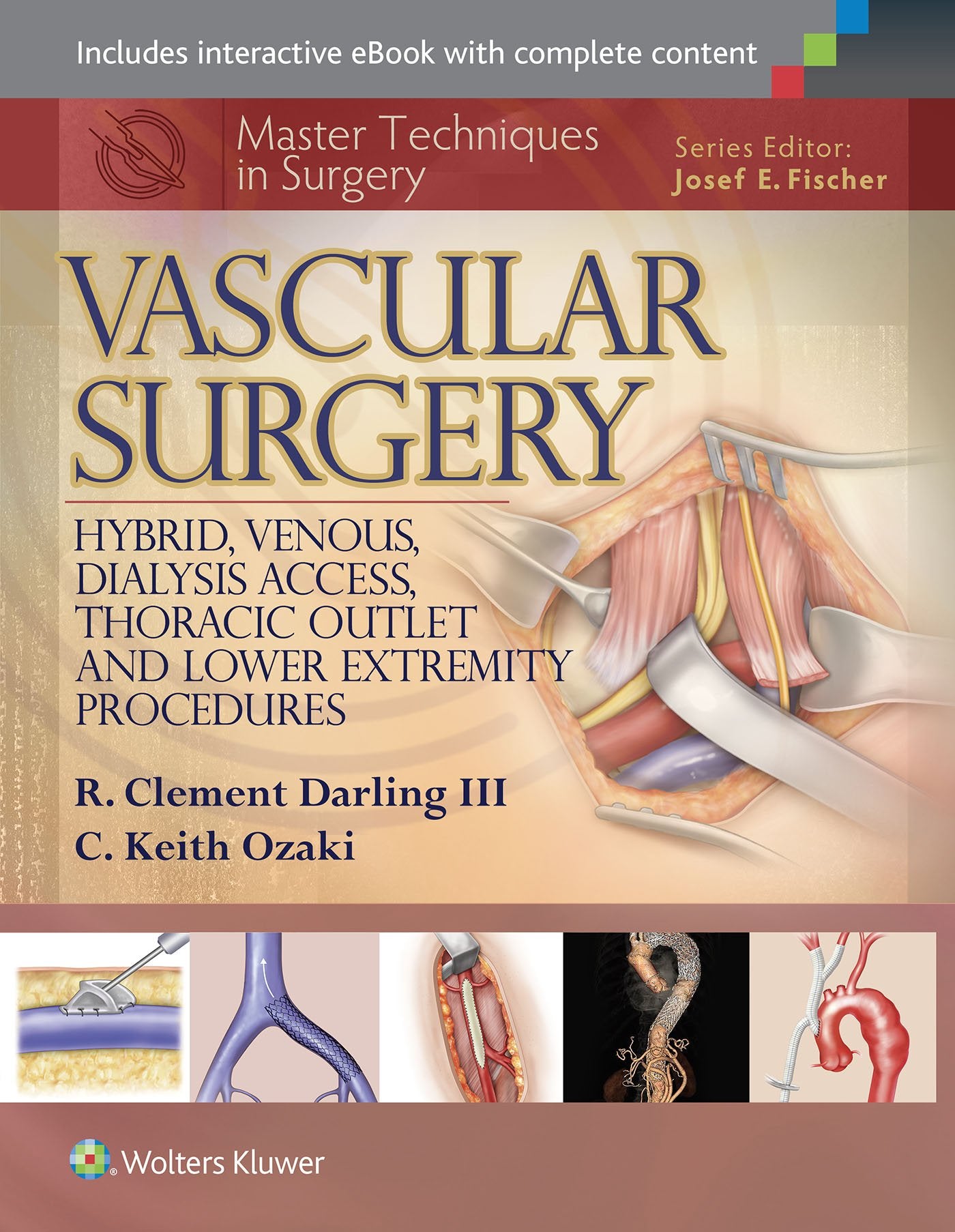 Master Techniques in Surgery: Vascular Surgery: Hybrid