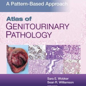 Atlas of Genitourinary Pathology: A Pattern Based Approach