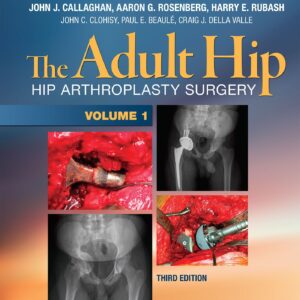 The Adult Hip (Two Volume Set): Hip Arthroplasty Surgery