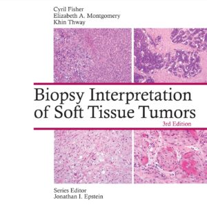 Biopsy Interpretation of Soft Tissue Tumors: Print + eBook with Multimedia (Biopsy Interpretation Series)