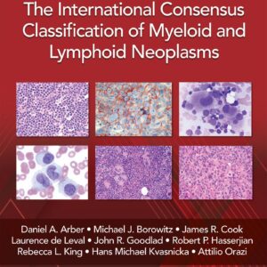 The International Consensus Classification of Myeloid and Lymphoid Neoplasms