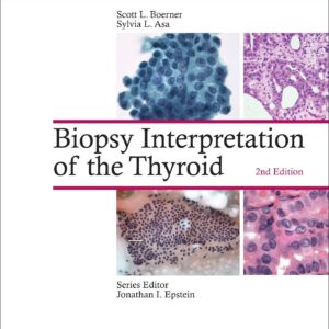 Biopsy Interpretation of the Thyroid