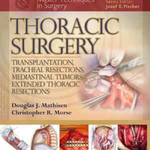 Master Techniques in Surgery: Thoracic Surgery: Transplantation