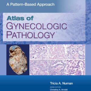 Atlas of Gynecologic Pathology: A Pattern-Based Approach: Print + eBook with Multimedia