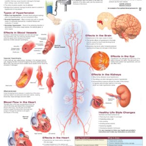 Understanding Hypertension Anatomical Chart