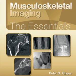 Musculoskeletal Imaging: The Essentials (Essentials Series)