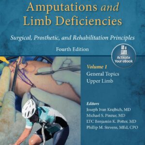 Atlas of Amputations & Limb Deficiencies