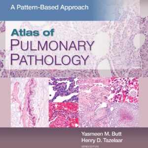 Atlas of Pulmonary Pathology: A Pattern Based Approach