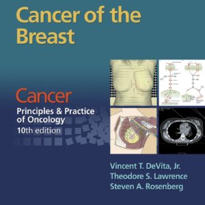 Cancer: Principles & Practice of Oncology. Cancer of the Breast