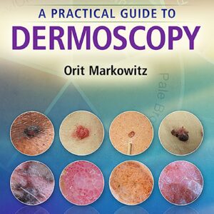A Practical Guide to Dermoscopy