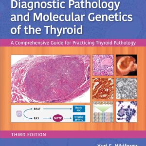 Diagnostic Pathology and Molecular Genetics of the Thyroid: A Comprehensive Guide for Practicing Thyroid Pathology