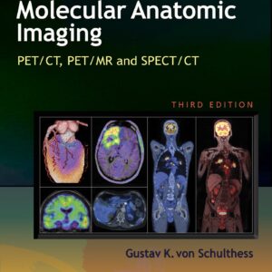 Molecular Anatomic Imaging: PET/CT