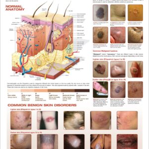 Common Lesions and Disorders of the Skin Anatomical Chart
