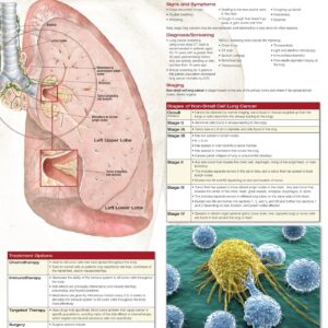 Non-Small Cell Lung Cancer